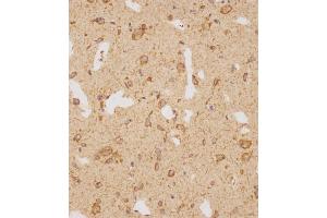 Immunohistochemical analysis of (ABIN1539214 and ABIN2838155) on paraffin-embedded human brain tissue was performed on the Leica®BOND RXm. (GATSL2 antibody  (N-Term))