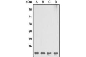 Western blot analysis of DBI expression in MCF7 (A), Raw264.