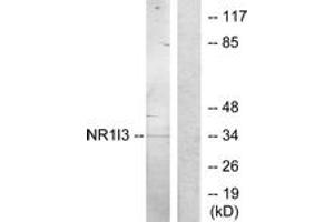 Western blot analysis of extracts from Jurkat cells, treated with serum 20% 15', using NR1I3 Antibody.