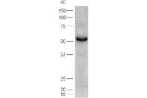Lane 1: mouse heart  probed with Rabbit Anti-ATGL/Adipose Triglyceride Lipase Polyclonal Antibody, Unconjugated (ABIN704756) at 1:300 overnight at 4 °C.