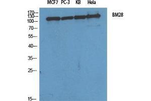 Western Blot (WB) analysis of specific cells using BM28 Polyclonal Antibody.