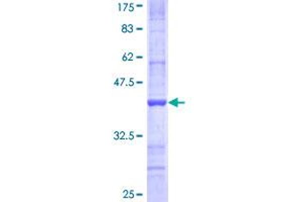 NDST3 Protein (AA 162-259) (GST tag)