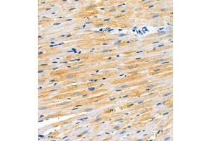 Immunohistochemistry of paraffin embedded rat heart using SCN4b (ABIN7075646) at dilution of 1:2000 (300x lens) (SCN4B antibody)