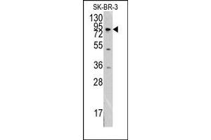 Image no. 1 for anti-Discoidin Domain Receptor tyrosine Kinase 1 (DDR1) antibody (ABIN359899) (DDR1 antibody)