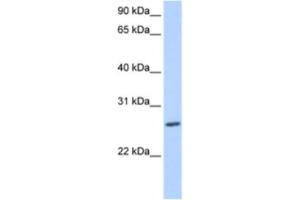 Western Blotting (WB) image for anti-Zinc Finger Protein 664 (ZNF664) antibody (ABIN2463457) (ZNF664 antibody)
