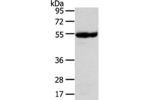 Western Blotting (WB) image for anti-Ubiquitin Associated Protein 1 (UBAP1) antibody (ABIN5961309)