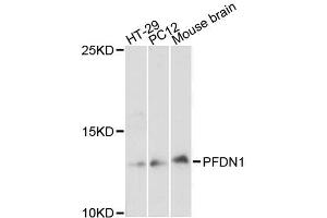 Western blot analysis of extracts of various cell lines, using PFDN1 antibody (ABIN5996513) at 1:3000 dilution. (PFDN1 antibody)