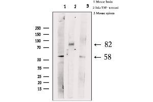 Western blot analysis of extracts from various samples, using Phospho-HSF1 (Ser303) Antibody. (HSF1 antibody  (pSer303))