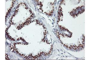 Image no. 1 for anti-Golgi Membrane Protein 1 (GOLM1) antibody (ABIN1498497) (GOLM1 antibody)