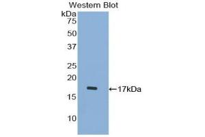 Detection of Recombinant PCT, Human using Polyclonal Antibody to Procalcitonin (PCT) (Procalcitonin antibody  (AA 26-141))