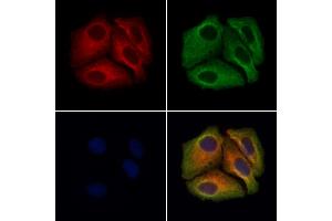 Transferrin Antibody staining Hela cells by IF/ICC.