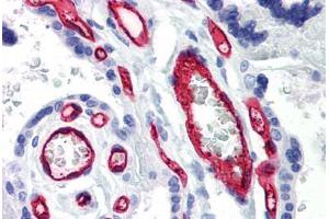 Human Placenta (formalin-fixed, paraffin-embedded) stained with CD34 antibody ABIN239805 at 10 ug/ml followed by biotinylated anti-mouse IgG secondary antibody ABIN481714, alkaline phosphatase-streptavidin and chromogen. (CD34 antibody)