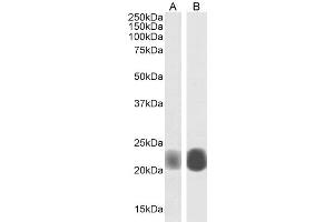 ABIN185421 (0. (Caveolin-1 antibody  (Internal Region))