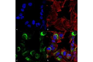 Immunocytochemistry/Immunofluorescence analysis using Rabbit Anti-AMBRA1 Polyclonal Antibody . (AMBRA1 antibody  (AA 200-300) (PE))