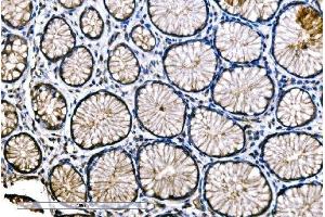 IHC analysis of SNAP23 using anti-SNAP23 antibody (ABIN7603236). (SNAP23 antibody  (N-Term))