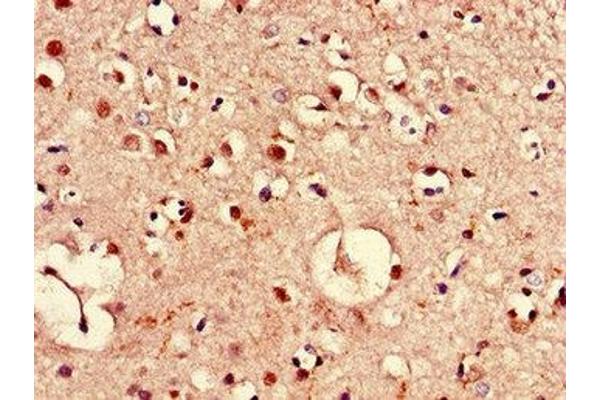 PIM3 antibody  (AA 278-326)