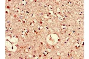 Immunohistochemistry of paraffin-embedded human brain tissue using ABIN7169149 at dilution of 1:100 (PIM3 antibody  (AA 278-326))
