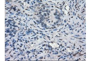 Immunohistochemical staining of paraffin-embedded colon tissue using anti-PORmouse monoclonal antibody. (POR antibody)