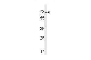 ZN Antibody (C-term) (ABIN1537388 and ABIN2848620) western blot analysis in HepG2 cell line lysates (35 μg/lane). (ZNF155 antibody  (C-Term))