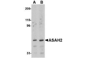 Western blot analysis of ASAH2 in 293 cell lysate with AP30083PU-N ASAH2 antibody at (A) 1 and (B) 2 μg/ml.