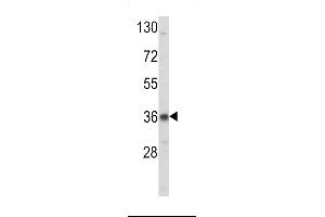 Western blot analysis of LDLR Antibody (N-term) (ABIN392553 and ABIN2842100) in K562 cell line lysates (35 μg/lane). (LDLRAP1 antibody  (N-Term))