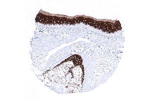 skin hairfollicel and sebaceous glands (Recombinant Keratin 10 antibody)