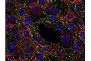 Immunocytochemistry staining of Sos in murine transformed fibroblasts using anti-Sos (SOS-01, red). (Sos antibody)