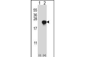 Western blot analysis of ARL2 (arrow) using rabbit polyclonal ARL2 Antibody  (ABIN650704 and ABIN2839229).