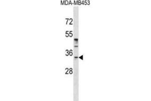 Western blot analysis in MDA-MB453 cell line lysates (35ug/lane) demonstrates that purified POU6F1 Antibody detects  POU6F1 protein (arrow). (POU6F1 antibody  (N-Term))