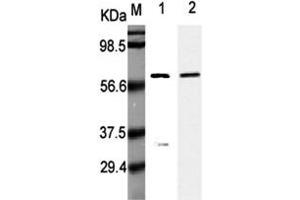 Western Blot analysis using anti-Listeria monocytogenes, mAb (P6007)  at 1:5000 dilution. (Listeria Monocytogenes, P60 antibody)