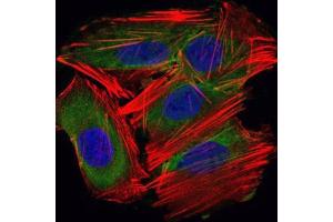 Immunofluorescence (IF) image for anti-Ubiquitin-Conjugating Enzyme E2I (UBE2I) antibody (ABIN969451)