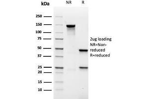 SDS-PAGE Analysis Purified MALT1 Recombinant Mouse Monoclonal Antibody (rMT1/410). (Recombinant MALT1 antibody  (AA 701-808))