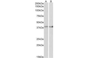 AP31421PU-N IDH3B antibody staining of Mouse Heart (A) and Mouse Muscle (B) lysate at 2 µg/ml (35µg protein in RIPA buffer). (IDH3B antibody  (AA 33-46))