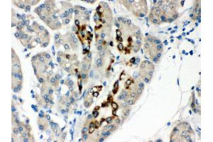 Anti- PAX6 Picoband antibody, IHC(P) IHC(P): Human Pancreatic Cancer Tissue (PAX6 antibody  (Middle Region))