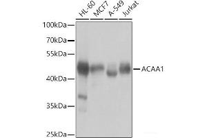 Western blot analysis of extracts of various cell lines using ACAA1 Polyclonal Antibody at dilution of 1:1000. (ACAA1 antibody)