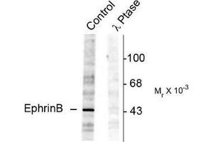 Image no. 1 for anti-Ephrin B1 (EFNB1) (pTyr298) antibody (ABIN372619) (Ephrin B1 antibody  (pTyr298))