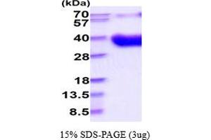 SDS-PAGE (SDS) image for CD80 (CD80) (AA 37-246) protein (His tag) (ABIN5854584) (CD80 Protein (CD80) (AA 37-246) (His tag))
