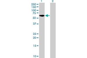 Western Blot analysis of ZNF777 expression in transfected 293T cell line by ZNF777 MaxPab polyclonal antibody. (ZNF777 antibody  (AA 1-518))