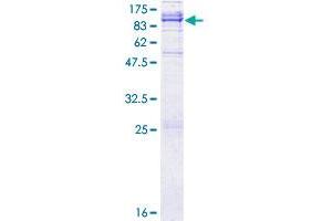 ADAM21 Protein (AA 1-722) (GST tag)