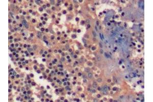 Detection of EGFR in Human Tonsil Tissue using Polyclonal Antibody to Epidermal Growth Factor Receptor (EGFR) (EGFR antibody  (AA 888-1210))