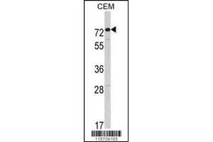 Western blot analysis of AMHR2 Antibody in CEM cell line lysates (35ug/lane) (AMHR2 antibody  (C-Term))
