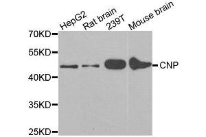 Western blot analysis of extracts of various cell lines, using CNP antibody. (Cnpase antibody  (AA 152-421))