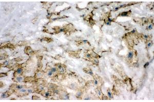 Anti-Superoxide Dismutase 3 antibody, IHC(F) IHC(F): Human Placenta Tissue (SOD3 antibody  (N-Term))