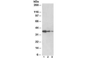 Western blot testing of human liver lysate [lane 1], mouse liver [lane 2] and rat liver [lane 3] with PP2A antibody at 0. (PPP2R4 antibody)