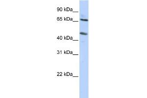 WB Suggested Anti-SLC26A10 Antibody Titration:  0.