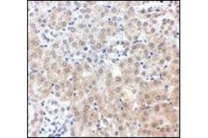 Immunohistochemistry of NPC1 in mouse kidney tissue with this product at 2. (NPC1 antibody  (C-Term))