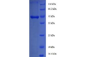 SDS-PAGE (SDS) image for Insulin-Like Growth Factor 1 (IGF1) (AA 49-118) protein (GST tag) (ABIN5712484)