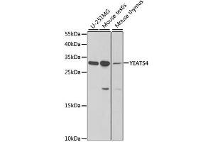 Western blot analysis of extracts of various cell lines, using YEATS4 antibody (ABIN1980334) at 1:1000 dilution. (GAS41 antibody)