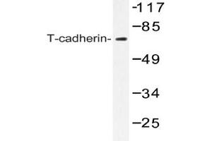 Image no. 1 for anti-Cadherin 13 (CDH13) antibody (ABIN272293) (Cadherin 13 antibody)