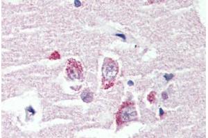 Anti-GPR98 antibody  ABIN1048902 IHC staining of human brain, cortex. (ADGRV1 / GPR98 antibody  (N-Term))